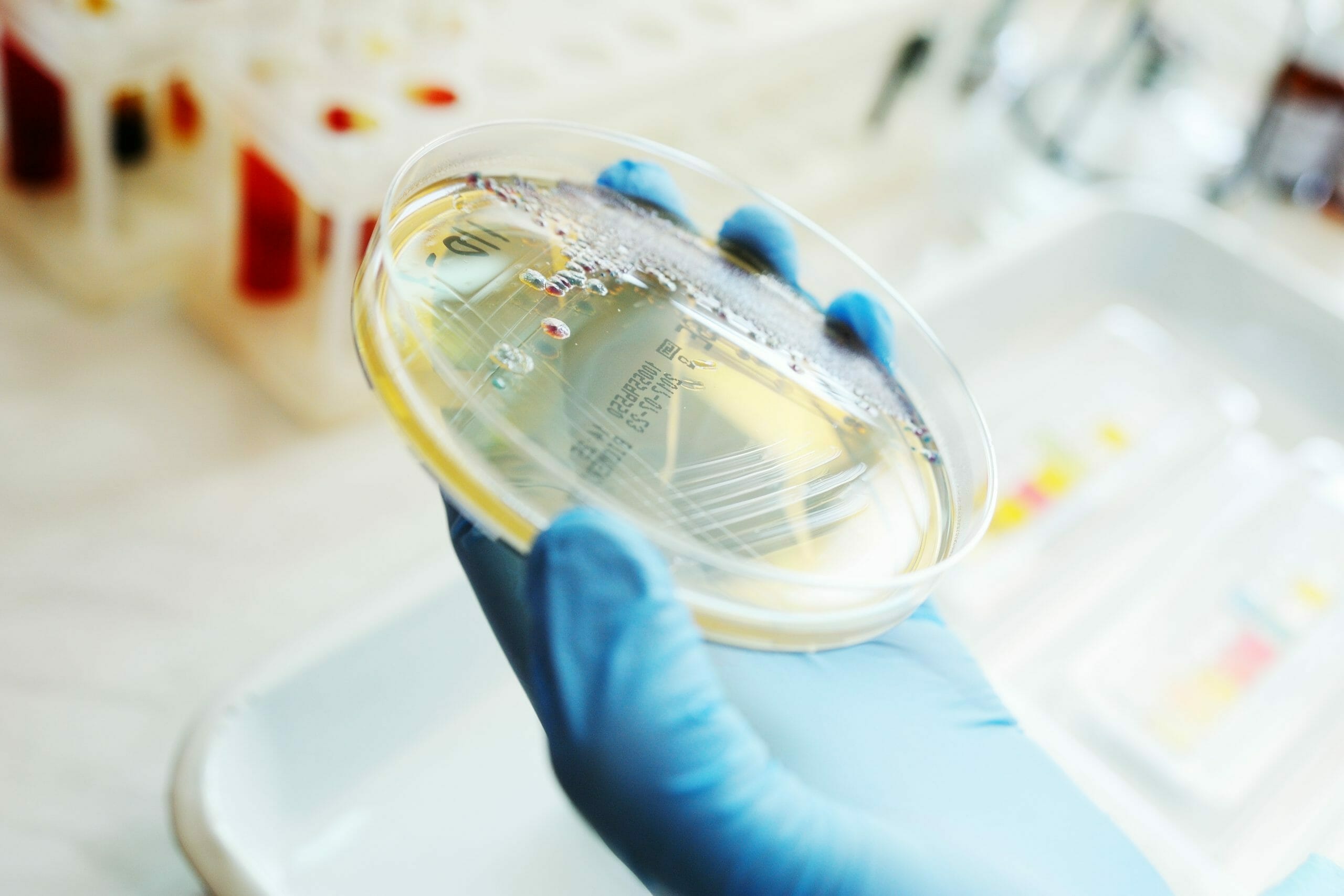 Section of a Petri dish with isolated colonies of bacteria